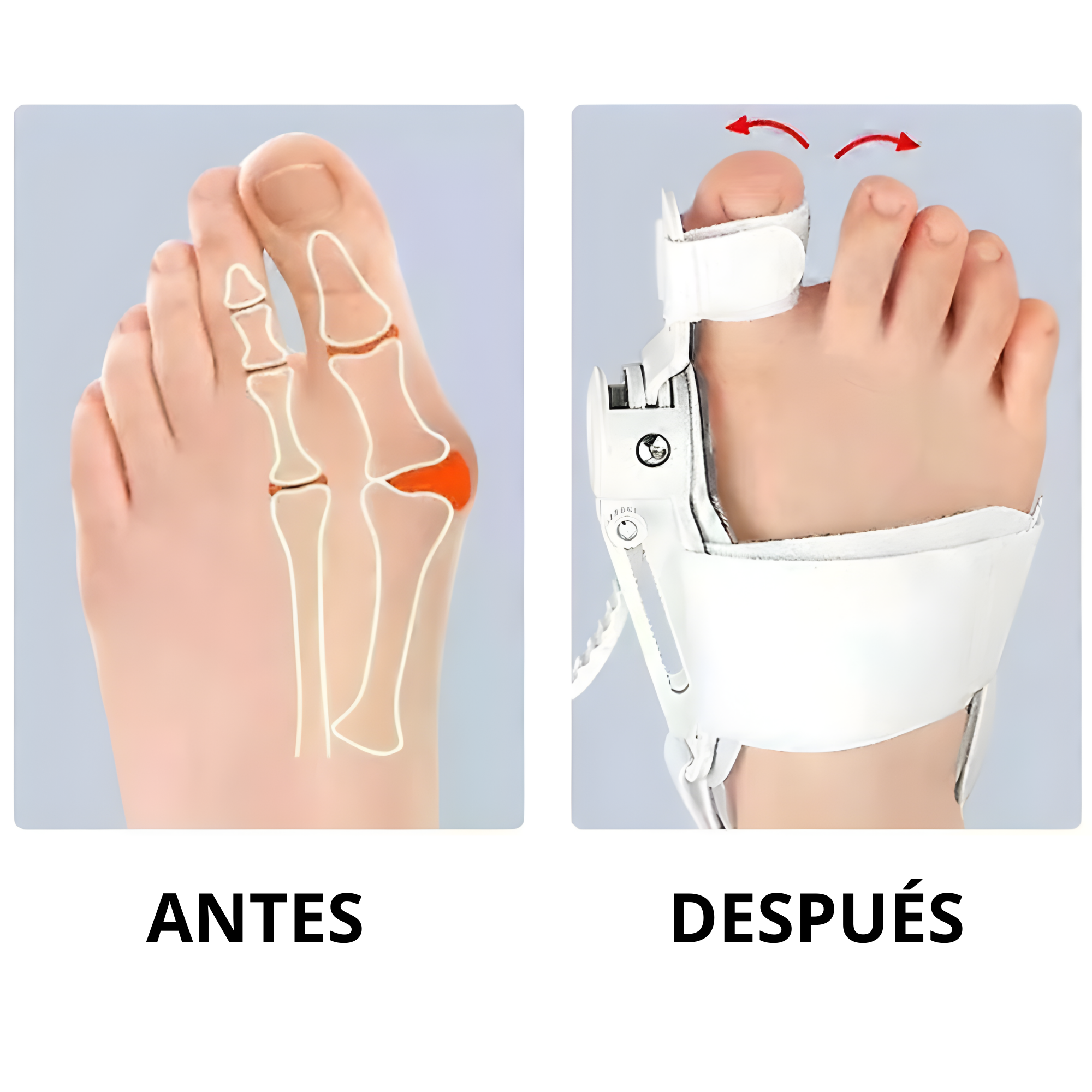 Juanete Corrector Ortopedico Ajustable